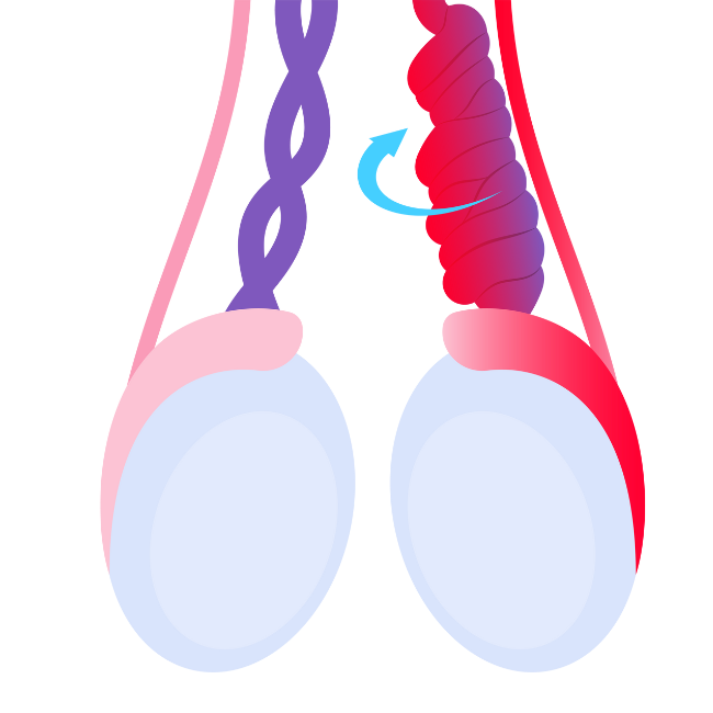 Tratamiento de varicocele en Querétaro