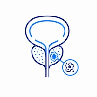 Prostata agrandada tratamiento Queretaro